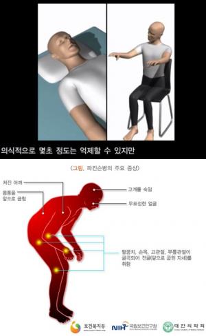 헌팅턴 무도병 및 파킨슨병, 정의-원인-초기증상-완치-치료는?