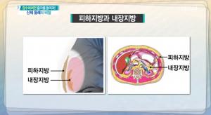 [종합] &apos;무엇이든 물어보세요&apos; 여기 둘레가 두꺼우면 돌연사 위험과 암, 당뇨 위험 증가! 예방법은?