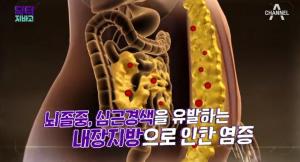 [종합] &apos;닥터 지바고&apos; 염증을 만들어내는 뱃살빼는 방법은? "내장지방과 염증을 방치하면 요요현상과 암, 심근경색까지!"