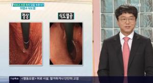 &apos;무엇이든 물어보세요&apos; 위염, 식도염의 원인과 증상, 대처법! "뱃살이 나오면 왜 식도염에 걸리기 쉬운가?"  (1)