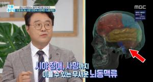 ‘기분좋은날’ 셋 중 하나는 사망? 머릿속 시한폭탄 ‘뇌동맥류’…귓불 주름 확인하세요