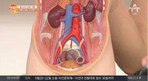 요로결석, 통증 및 증상과 제거는?…예방 방법도 눈길