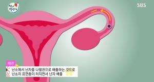 &apos;좋은아침&apos; 자궁이 걱정된다면? &apos;속옷 살피기&apos; 중요..전문의 상담 필요 (2)