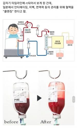 일본, 안티에이징-면역 증진 위한 ‘혈액 클렌징’ 유행…자칫 감염 위험 ‘경악’