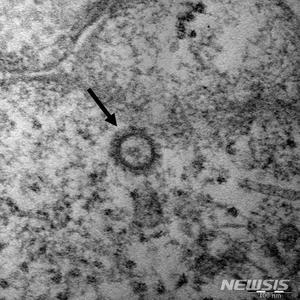 사망자 53%, 병원·시설서 감염…신천지 관련 21명(종합)