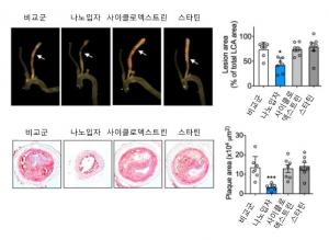 한국과학기술원(KAIST), 사이클로덱스트린-스타틴 나노 입자로 콜레스테롤 녹이는 기술 개발…심근경색·뇌졸중·동맥경화증에 희소식