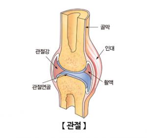 무릎 연골 영구 대체 가능한 특수 젤 개발…미국 듀크대학팀 개발, 임상만 3년 걸려