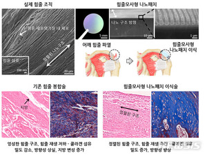 전남대 연구팀, 나노기술로 &apos;어깨힘줄 파열 치료법&apos; 개발