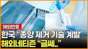 [영상][해외반응] 한국 "종양 제거 기술 개발" 해외네티즌 "글쎄.."