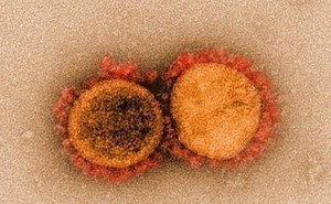 [코로나 연구] 스파이크 돌연변이 32개인 코로나19 변이 바이러스, 보츠와나·남아공에서 발견