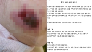 "5살 딸 엉터리 치료로 뺨 괴사" 주장에…병원 측 입장 "감기증상으로 내원, 허위사실"