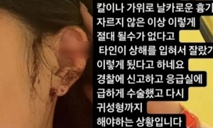 "상해 정황 없다" 강남 클럽 귀 절단사건, 경찰 CCTV 확인 결과 