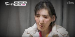 "극단적 선택 생각도"…전 농구선수 김영희, 거인병 투병 후 근황