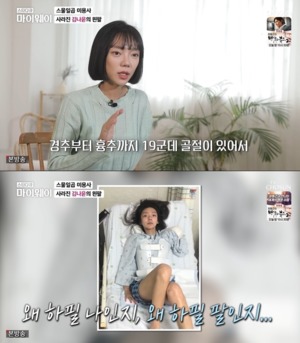 "접합했지만 패혈증이…" 피트니스 선수 김나윤, 27살 교통사고로 팔 절단
