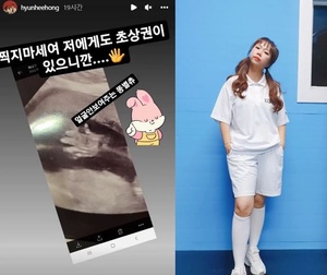 "찍지마세요"…&apos;제이쓴♥&apos; 홍현희, 2세 초음파 사진 공개