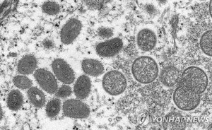 유럽서 원숭이두창 속속 확산…독일 "감염자 21일간 격리" 권고