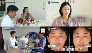 ‘살림남’ 이천수, 성형견적 3000만원에 깜놀…심하은은 코성형 부작용에 성괴 악플 ‘눈물’ (2)