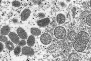 원숭이두창 전세계 1800명 돌파, 비상사태 선포 가능성?…국내 기업도 예의주시