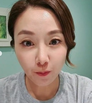 김지혜 "담낭 제거 수술한 지 1년…소화력 급격히 떨어져"
