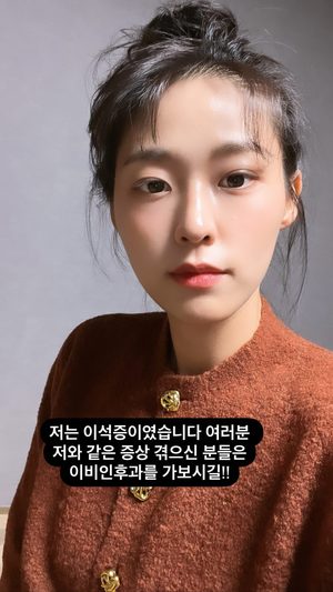 "이비인후과 가보시길"…AOA 설현, 건강 이상 호소→이석증 진단