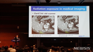 "방사선량 &apos;3분의1&apos; 인공지능 CT로 간암진단 가능"