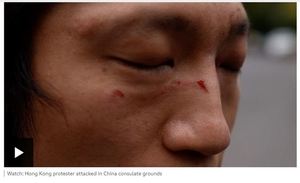 英, &apos;홍콩 시위대 폭행&apos; 관련 중국 외교관 초치