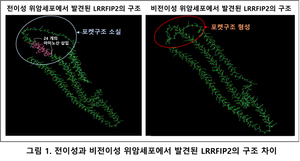 길로 연구소‧메드팩토 "위암세포 간 전이 조절 단백질 발견"