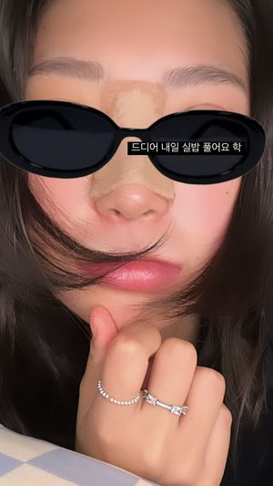 “실밥 제거 대기”…故 최진실 딸 최준희, 성형수술 후 얼굴 상태 공개