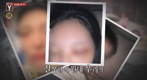 &apos;궁금한 이야기Y&apos; 압구정 펀치 사건 추적…"배우 지망생 얼굴 뼈 부서져"