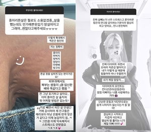 故 최진실 딸 최준희, 다이어트 후 튼살 공개…“익숙해져 스트레스 안 받아”