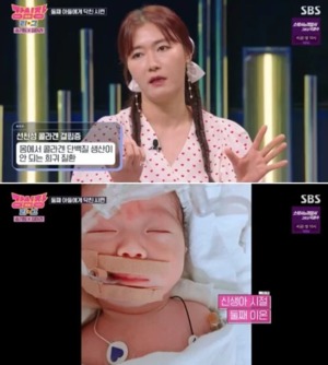 김미려, 둘째 아들 &apos;선천성 콜라겐 결핍증&apos; 투병…"내 탓 같았다"