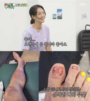 박선영, 부상도 말리지 못한 축구 사랑…현재 몸 상태는?