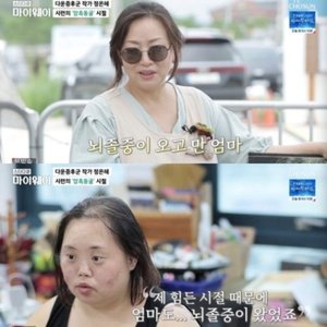 정은혜 母, &apos;다운증후군&apos; 딸 돌보다 뇌졸중 투병…"삶 바닥치는 느낌"