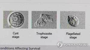 대만 30대 여성, &apos;뇌 먹는 아메바&apos; 파울러자유아메바 감염으로 7일만에 사망