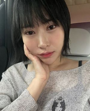 이세영, 쌍꺼풀수술 또 했나?…확 달라진 외모, 퉁퉁 부은 눈