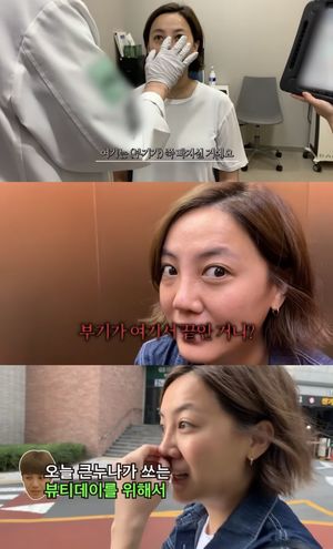 고은아, 코 재수술 후 근황 공개…성형외과의 2차 수술 언급