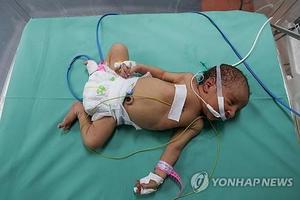 연료 바닥나는 병원들, 임박한 발전 중단으로 아기들 죽음 목전(이스라엘 팔레스타인 전쟁)