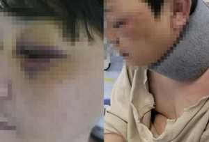 조직폭력배?…김포 40대 학부모, 아이 아빠 폭행→신상 확산 