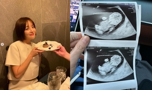 황보라, 차현우와 결혼 1년 만에 임신…하정우 조카 생긴다