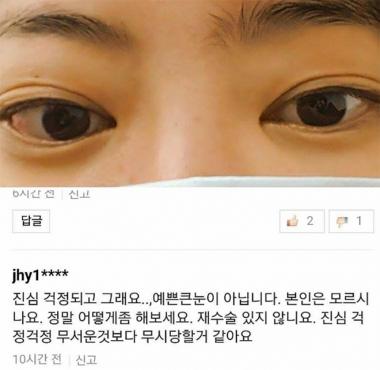 [스타SNS] 서유리, 눈 성형 관련 갑상선항진증-그레이브스병 앓아…‘의혹에 일일이 대응’