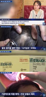 ‘JTBC 뉴스룸’ 탈모인들, “탈모치료도 건보 적용해야한다”…‘탈모갤이 또’