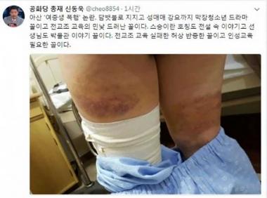 신동욱, 아산 여중생 폭행에 “담뱃불·성매매 막장 청소년 드라마”