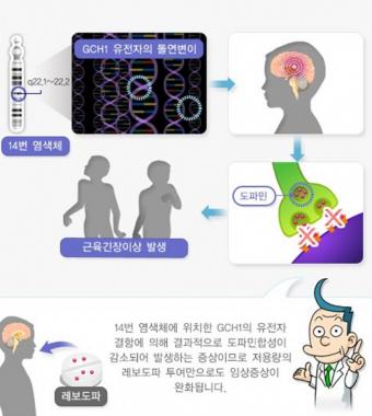 세가와병, 일명 ‘도파 반응성 근육긴장이상’…주로 저녁에 심해지고 수면 이후 호전